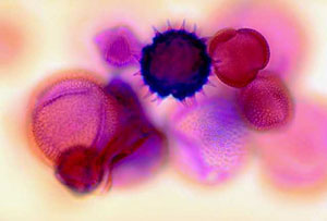 cell suspension