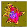 inflammation