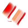 inflammation
