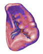 spleen